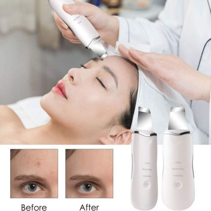 Ultrasonic Skin Scrubber Pen