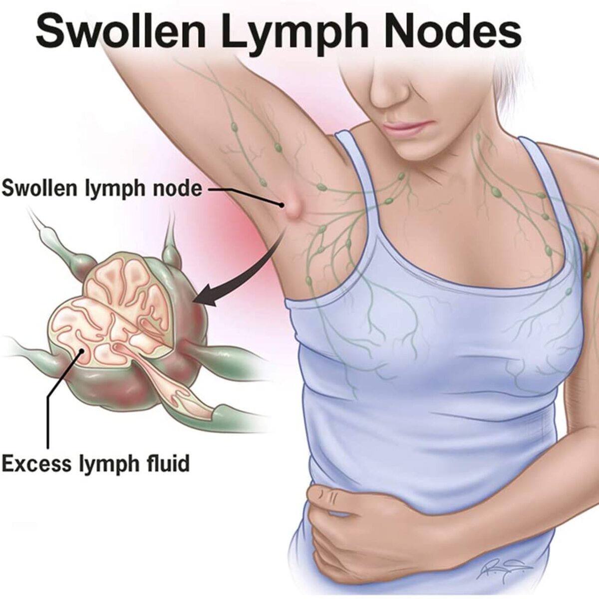 Herbal Lymph Care Patch