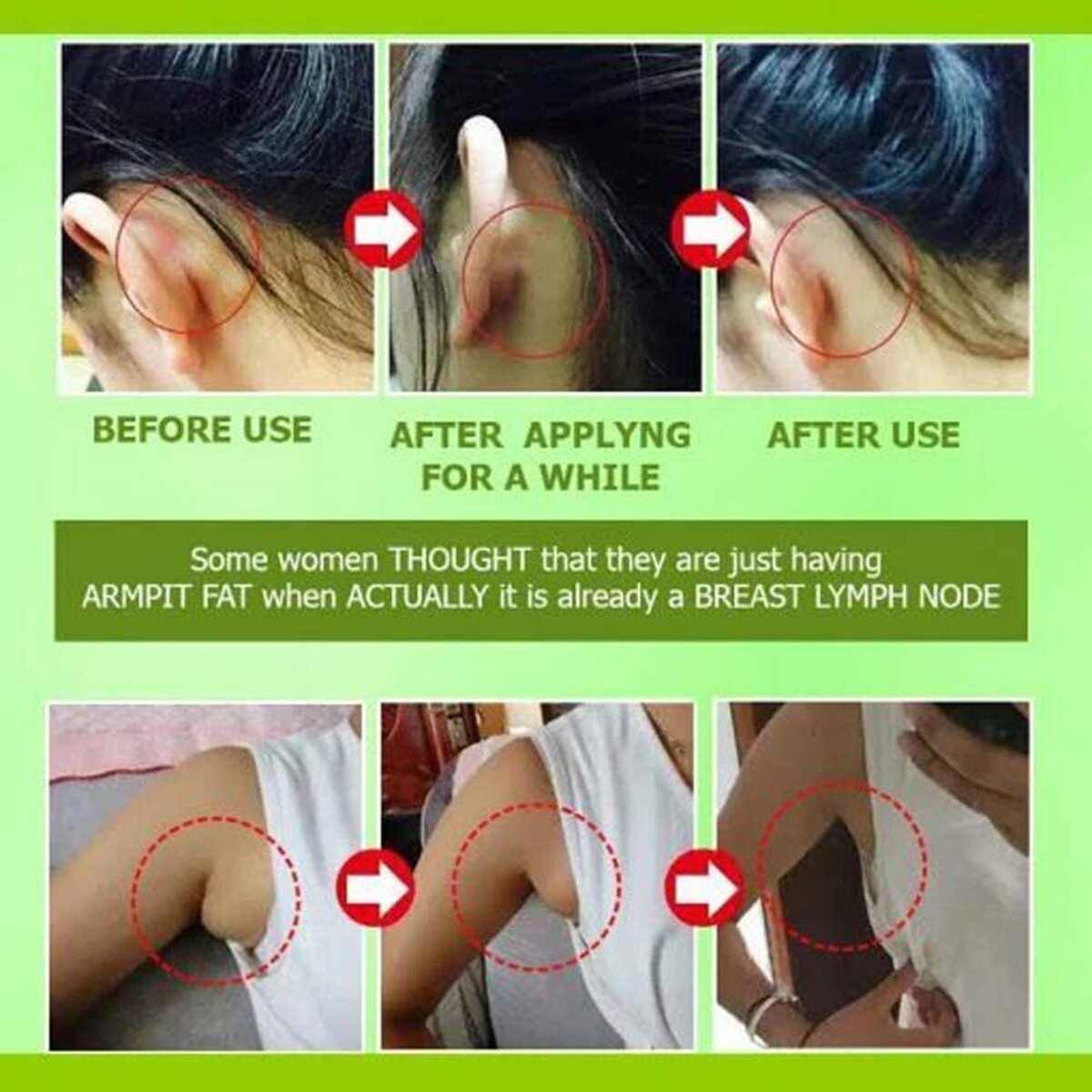 Herbal Lymph Care Patch