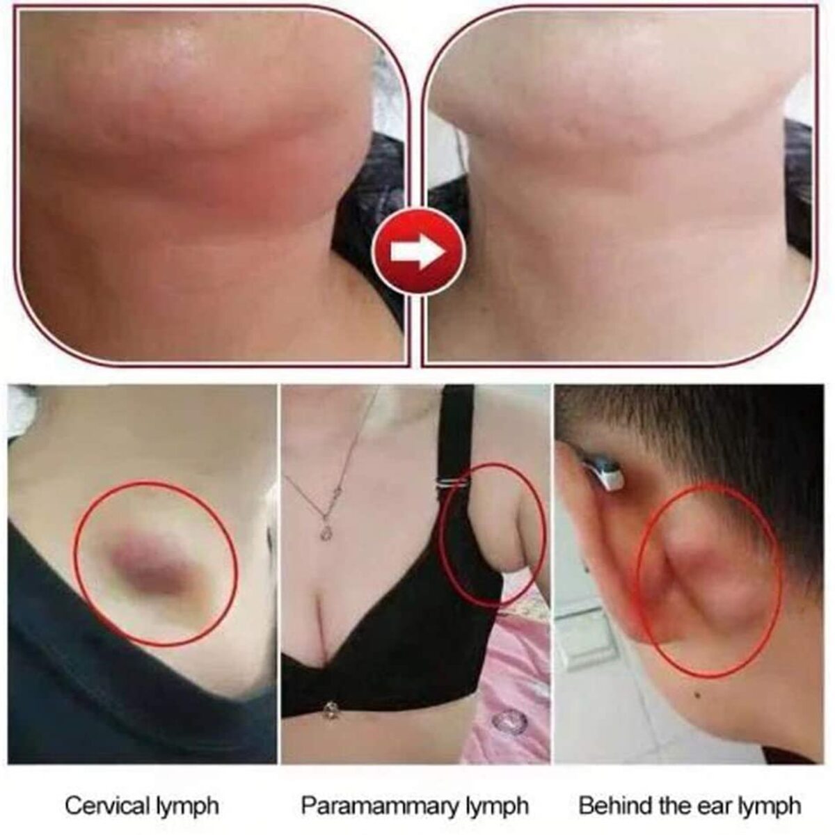 Herbal Lymph Care Patch