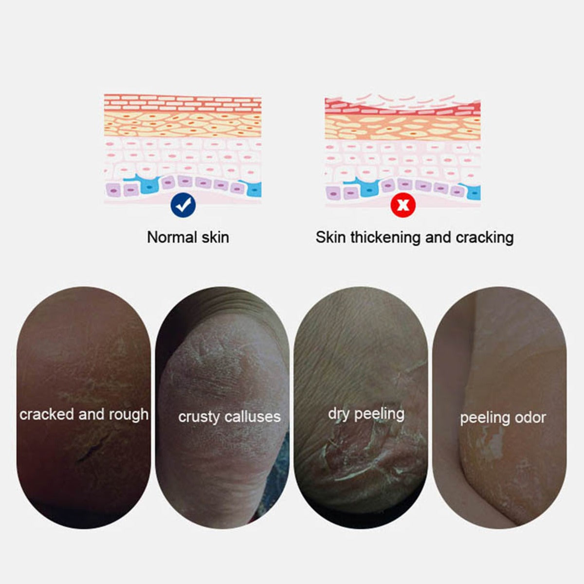 1 Pair Heel Moisturizing Sleeves