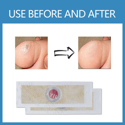 6Pcs Corn Remover Pads With tool