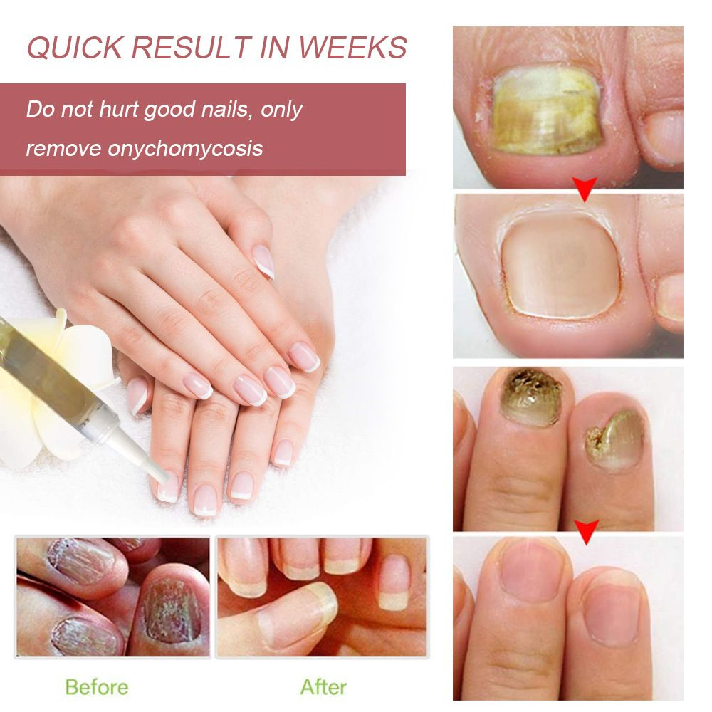 Nail lotion a bright biological repair fluid nail care fluid