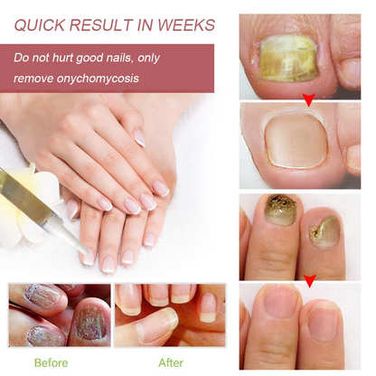 Nail lotion a bright biological repair fluid nail care fluid